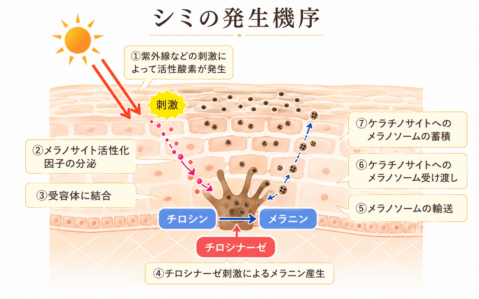 しみの発生メカニズム図