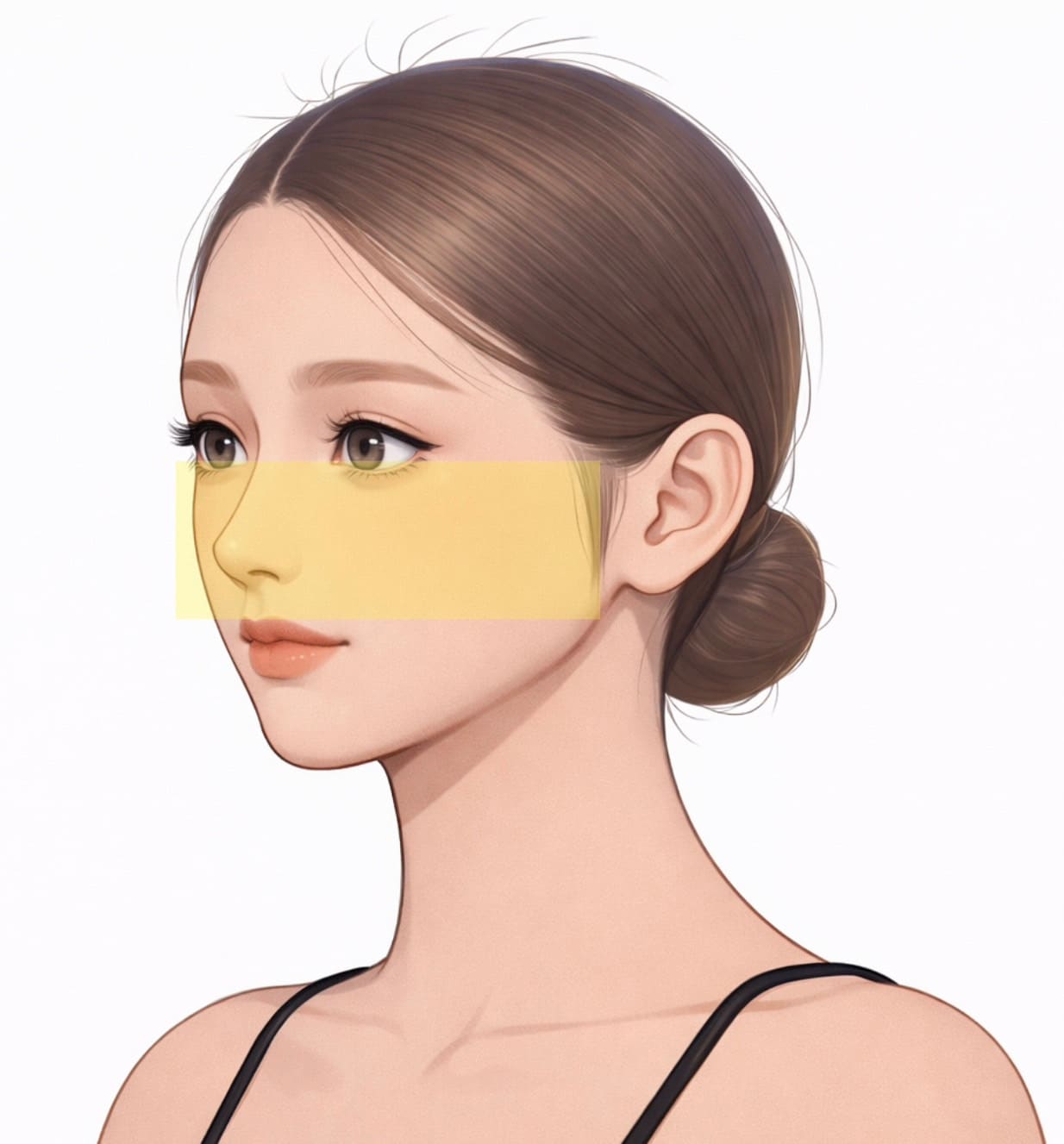 中顔面の変化イラスト - 頬のたるみ、チークトップの下垂