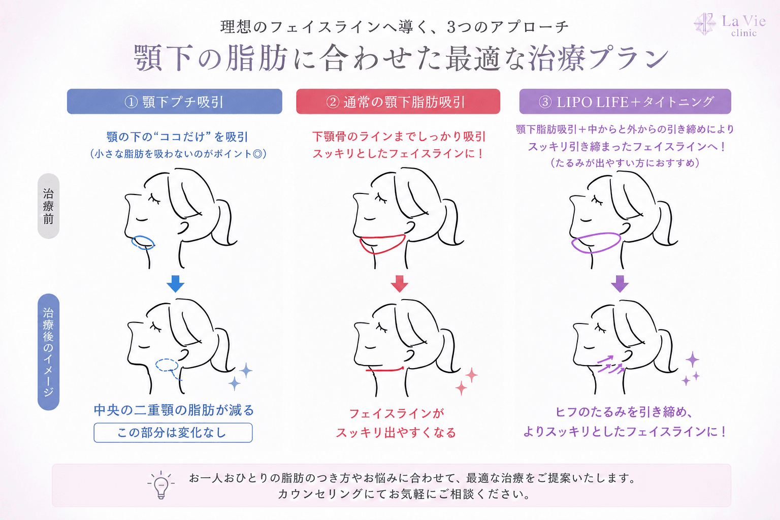 施術範囲の違いで選べる2つのメニュー