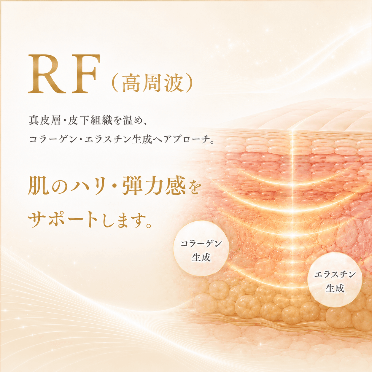 シンクロ波(Synchronized RF)