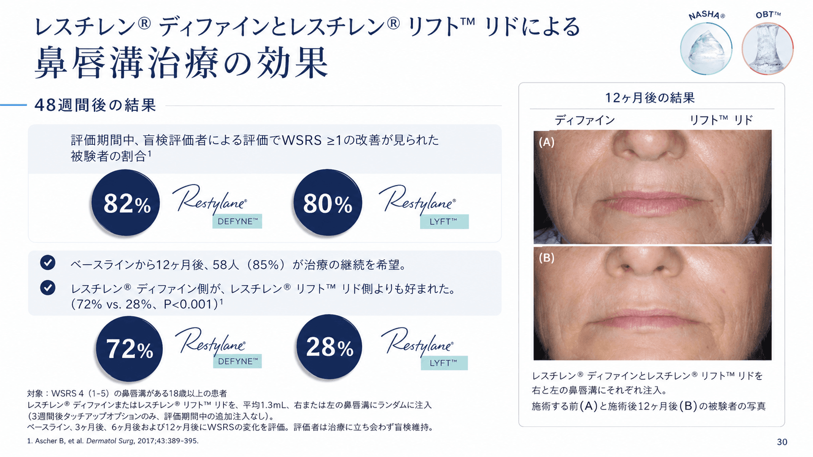 レスチレン参考画像2