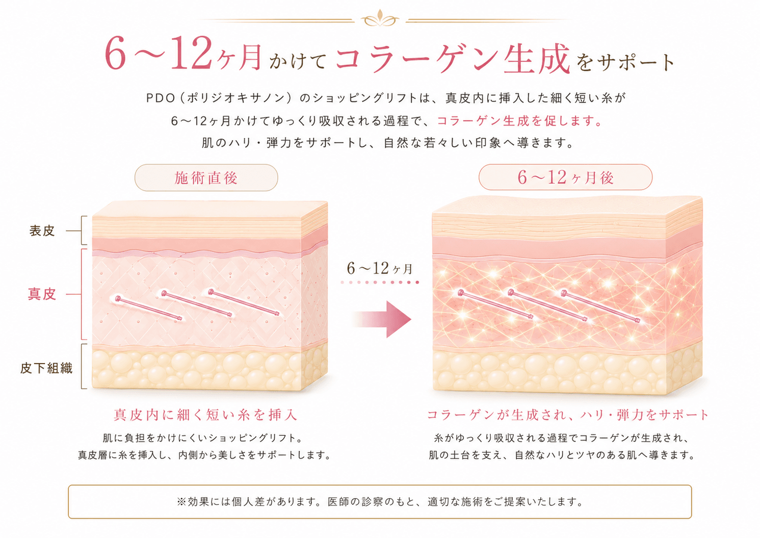 ショッピングリフト 参考画像