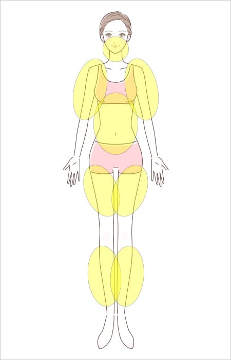 LipoLife脂肪吸引治療可能部位イラスト