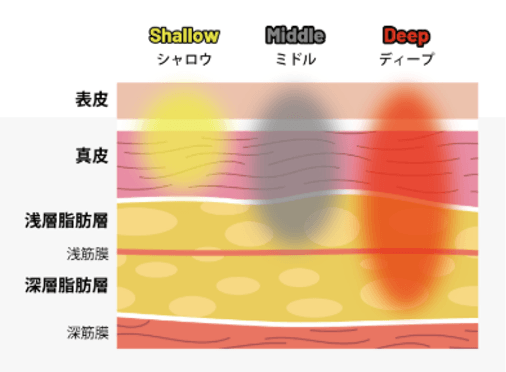 3つの深さモード - Shallow、Middle、Deep