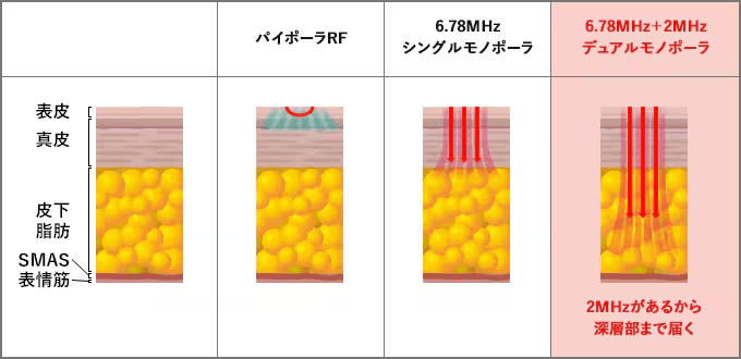 デュアル周波数の仕組み